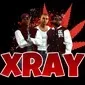 xRay